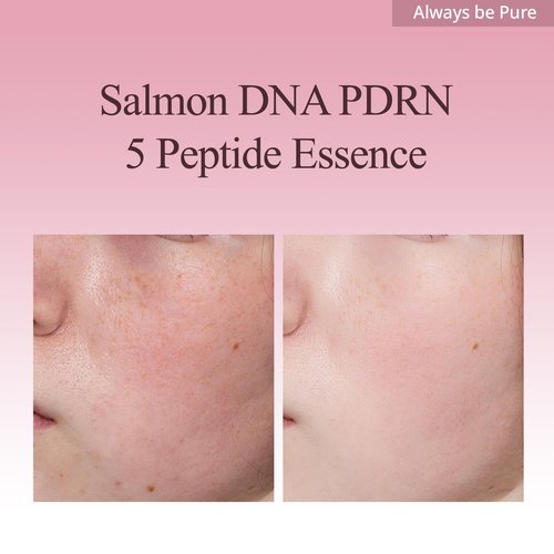 Always Be Pure Marine Origin Mela-PDRN Peptide Essence, Skin Renewal Serum with Salmon DNA, Niacinamide for Glowing Skin, Korean Skincare, 150ml/5.07 fl.oz.