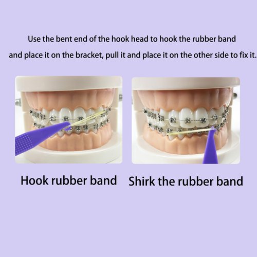 Maoerdental 100PCS Elastic Rubber Bands Placers Tool for Braces,Colorful Disposable Plastic Orthodontic Elastic Placers Braces Rubber Band Tool