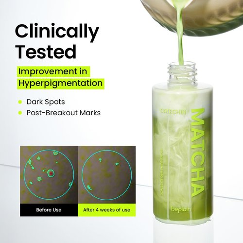 beplain Matcha Catechin Skin Purifying Essence for Face | Hydrating & Balancing Facial Essence for Glowy, Healthy Skin | Suitable for Sensitive Skin | K-Beauty (5.07 fl oz / 150 ml)