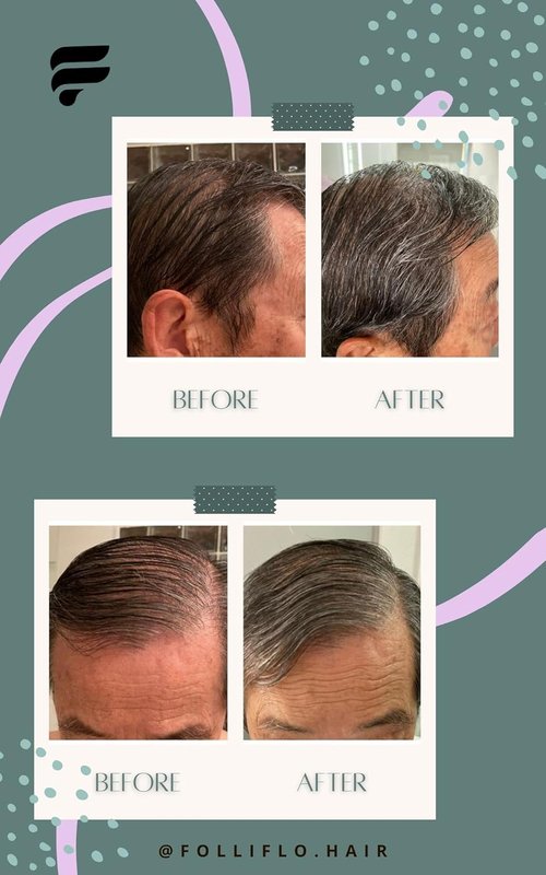 Folliflo Hair Boost Leave-In Conditioner Spray | Lightweight Daily Serum for Thicker Hair - 90 Day Supply