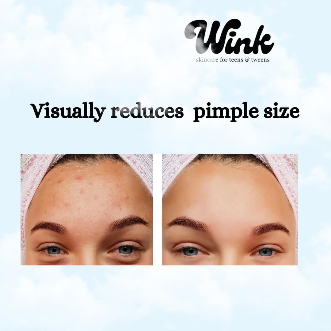 Wink Hydrocolloid Pimple Patches, 120-Count (Exclusive Gem/Bling Acne Stickers) Gentle Tea Tree & Centella For Face Skincare - Star, Heart, Flower And Cloud Shapes, Teen Tween Girl Facial Treatment