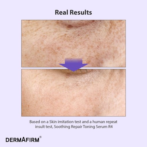 DERMAFIRM Bakuchiol Retinol Serum - Soothing Daily Skin Care with Niacinamide & Peptides for Sensitive Skin | R4 Glass Skin Toning Serum
