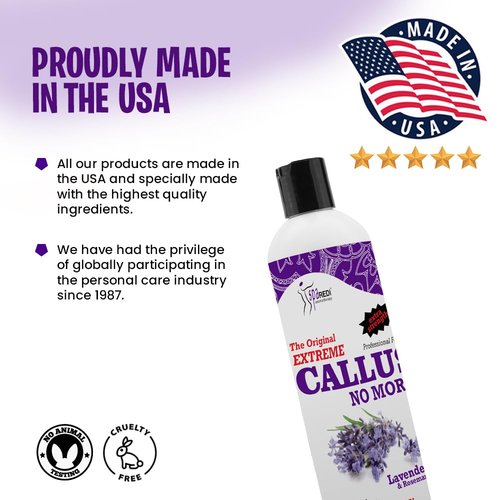 SPA REDI Callus Remover - Professional-Grade Callus Dissolving Treatment - Stop Scraping. Start Dissolving. Chemically Dissolve Toughest Buildup for a Dramatic 'Wow' Transformation 12 Oz