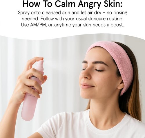 grace & stella Hypochlorous Acid Spray for Face - Body Acne Spray - Gentle Face Mist to Calm Redness & Flare-Ups Back Acne - Soothing Facial Mist for Sensitive Skin - Travel Size (60 ml/2 fl oz)
