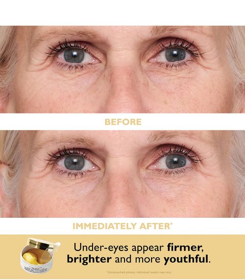 Peter Thomas Roth | Travel Pack Eye Patches - Hydrating & Revitalizing Treatment