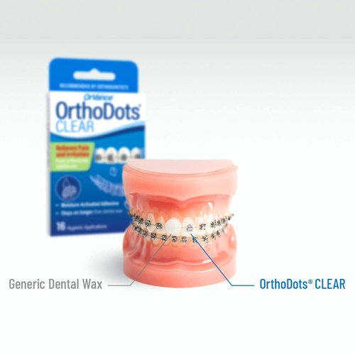 OrthoDots Clear – 24-Hour Protection | Sticks Better Than Dental Wax | Moisture Activated Braces Wax Alternative for Pain Caused by Braces, Clear Aligner Trays, and Other Orthodontic Appliances
