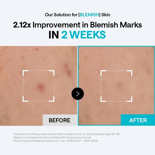 MEDIHEAL Madecassoside Blemish Pad - Square Cotton Facial Toner Pads with Centella Asiatica & Madecassoside – Anti Blemish to Improve Uneven Skin Tone - Vegan Face Gauze Pads, 100