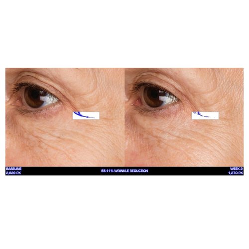Serious Skincare - Ultra-Mare Pure Marine Infusion Eye Cream - Revitalizing Peptides - 0.5 oz