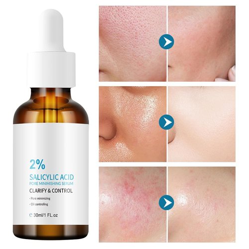 Regine Switzerland 2% Salicylic Acid Serum - Acne Treatment, Blackhead Control & Oil Reduction