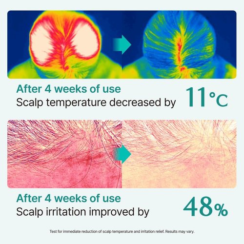 Lilyeve SCALPTURN Cica PDRN Scalp Serum - Strengthen Hair Roots & Relieve Itchy Scalp | 3.38 fl. oz