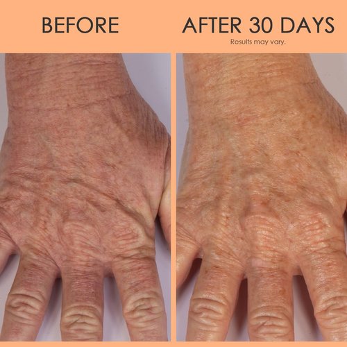 Crepe Erase Hand Repair Treatment - Anti-Aging Lotion with Shea Butter & Vitamin E | 3 fl oz