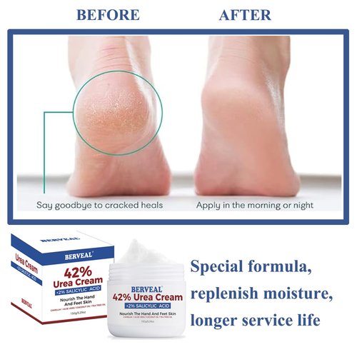 BERVEAL Urea Cream with 2% Salicylic Acid Foot Cream for Dry Cracked Heels, Heel Care Cream 5.29 Oz (Pack of 1)
