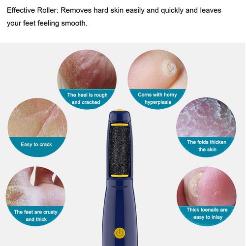 Replacement Roller Compatible with Dr. Scholl's Callus Remover Electronic Foot File-Extra Coarse (12 Pack)