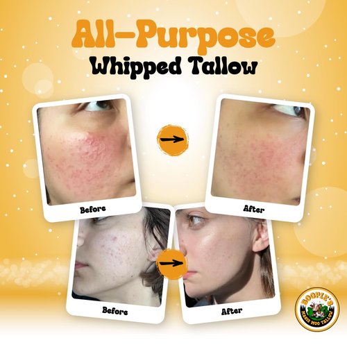 Magic Moo Whipped Beef Tallow Skincare - Organic Moisturizer for Acne, Eczema & Dry Skin | 4oz