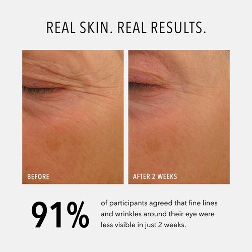 HydroPeptide Eye Authority - Brightening Eye Cream for Radiant, Youthful Eyes | 0.5 Ounce