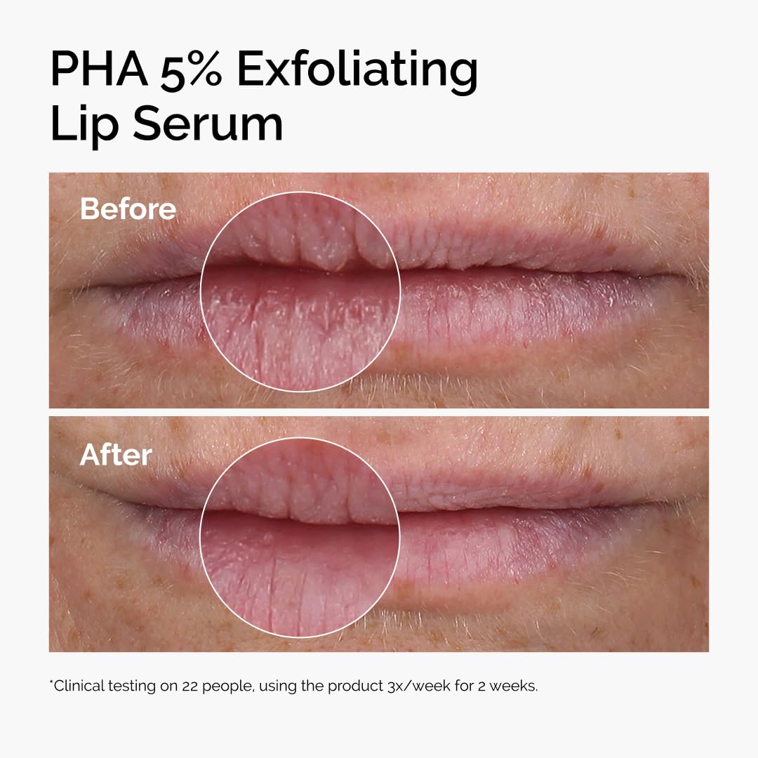 The Ordinary Lip Care Duo | PHA 5% Exfoliating Lip Serum & Squalane Lip Balm Set - 0.5 Fl Oz