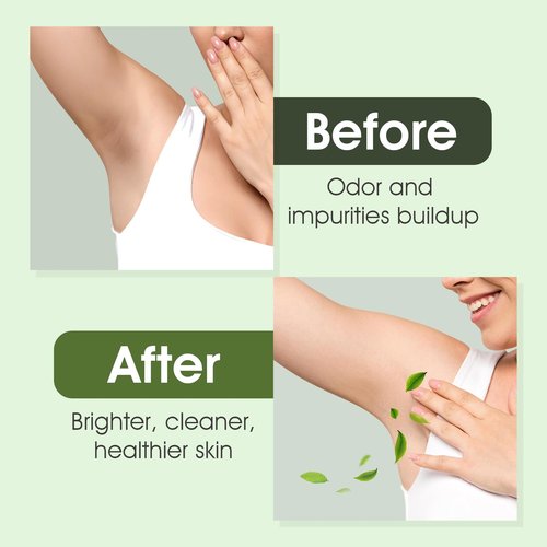 Underarm Detox Soap, 2 Pcs Armpit Detox Soap with Green Tea & Tea Tree, Charcoal & Mint for Eliminating Odor, Exfoliating, Moisturizing , Bar Soap for Legs, Knee, Feet, Hands Whole Body - 10 oz（280g）