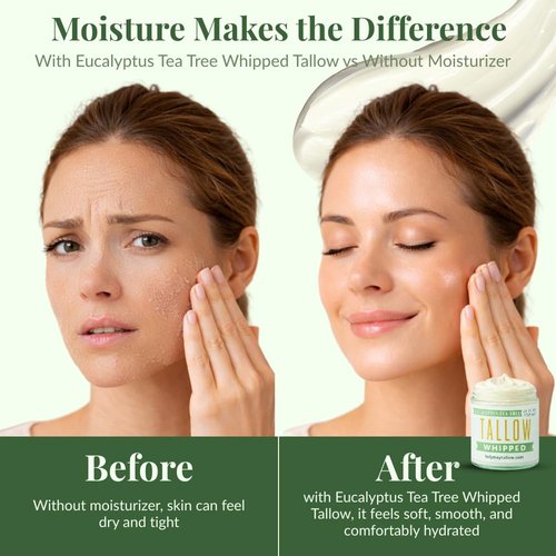 Lady May Tallow Whipped Tallow 24oz - All Natural Face Cream + Whole Body Moisturizer for Dry Skin - Made With Eucalyptus Oil - No Preservatives, Parabens or Seed Oils -USA Made (Eucalyptus Tea Tree)