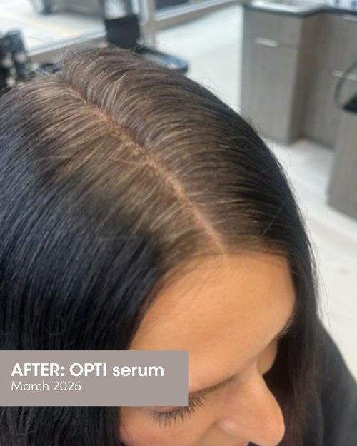 SEVEN SATARA OPTI Shampoo - Hair Growth & Thinning Solution with Procapil + Capixyl | 7 fl oz