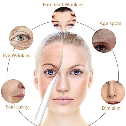 Skiennix Vitamin C Face Serum - Fade Dark Spots & Wrinkles with Hyaluronic Acid | 1 fl. oz.