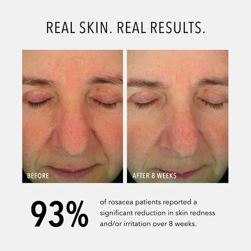 Hydropeptide Soothing Serum - Moisturizing Anti-Aging Peptide Facial Serum | 1 Ounce