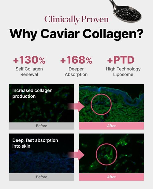 Delere Caviar Glow Smoothing Serum - Caviar Collagen, Niacinamide & Retinol for Radiant Skin | 1.7oz