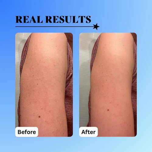10% Glycolic Treatment Tonic Exfoliating Toner for Face and Body, Alcohol Free, Combats Acne and Hyperpigmentation, Rough Skin, All Skin Types Including Sensitive