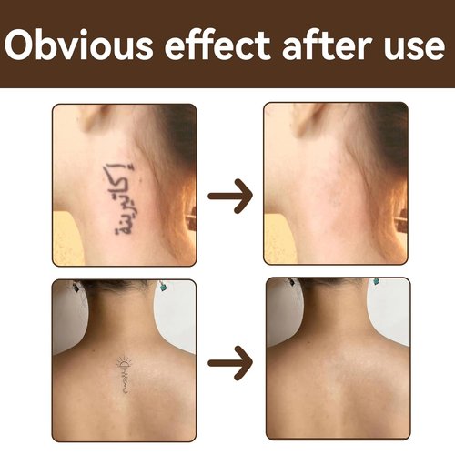 Regine Switzerland Tattoo Cover Up - Waterproof Concealer for Scars & Dark Spots | 2 Pcs Set