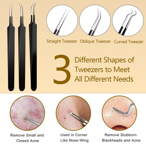 BXUYAOXMC 10Pcs Stainless Steel Pimple Popper Tool Kit, Blackhead Remover Tools Comedone Extractor Set, Acne Needle Tweezers for Facial Nose Care, with Metal Travel Case