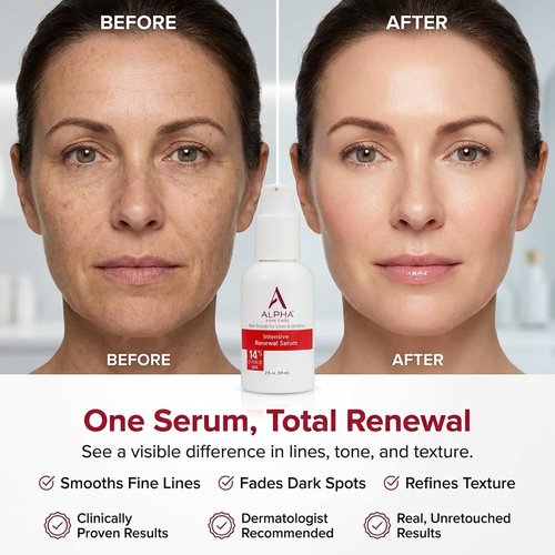 Alpha Skin Care Renewal Serum, 14% Glycolic AHA, Anti-Aging Formula, Reduces Lines & Wrinkles, Alpha Hydroxy Acid Exfoliates & Evens Skin Tones, Rejuvenates & Hydrates, 2 Oz