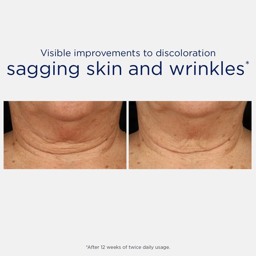 NEOSTRATA Triple Firming Neck Cream - New Formula with MicroDiPeptide229® & Bakuchiol | Fragrance-Free, 80g