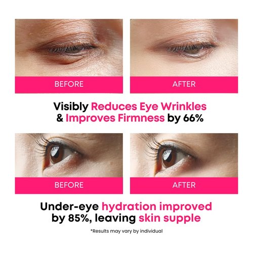 Skiennix 360° Collagen Eye Masks - Korean Under Eye Patches for Fine Lines & Dark Circles, 50 Masks