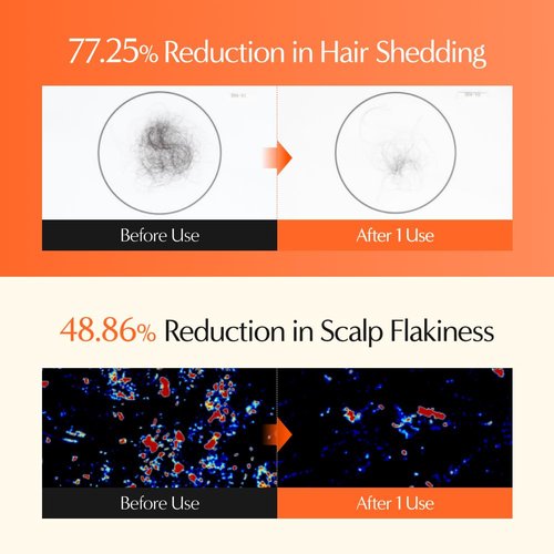 Lilyeve GrowTurn 3D Volume Shampoo - Built-In Brush for Thinning Hair & Fuller Volume | 6.76 Fl Oz