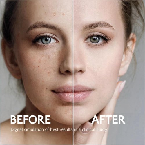 Hydraquinon0l Dark Spot Brightening Cream - 4% Non-Irritating Hydrating Formula for All Skin Types, 1oz