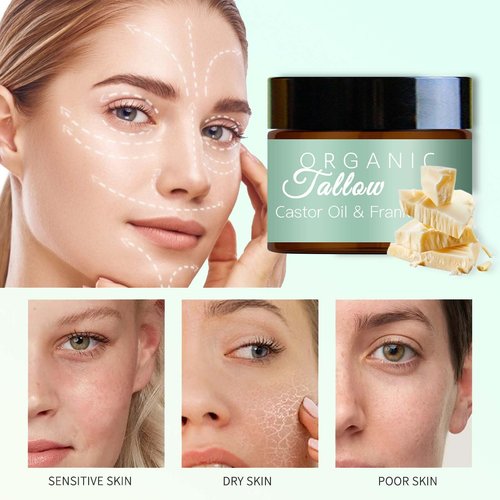 2PCS Grass Fed Beef Tallow with Frankincense Oil and Castor oil, Organic Beef Tallow Moisturizer for Skin, Organic Beef Tallow and Manuka Honey Balm for Face, Body