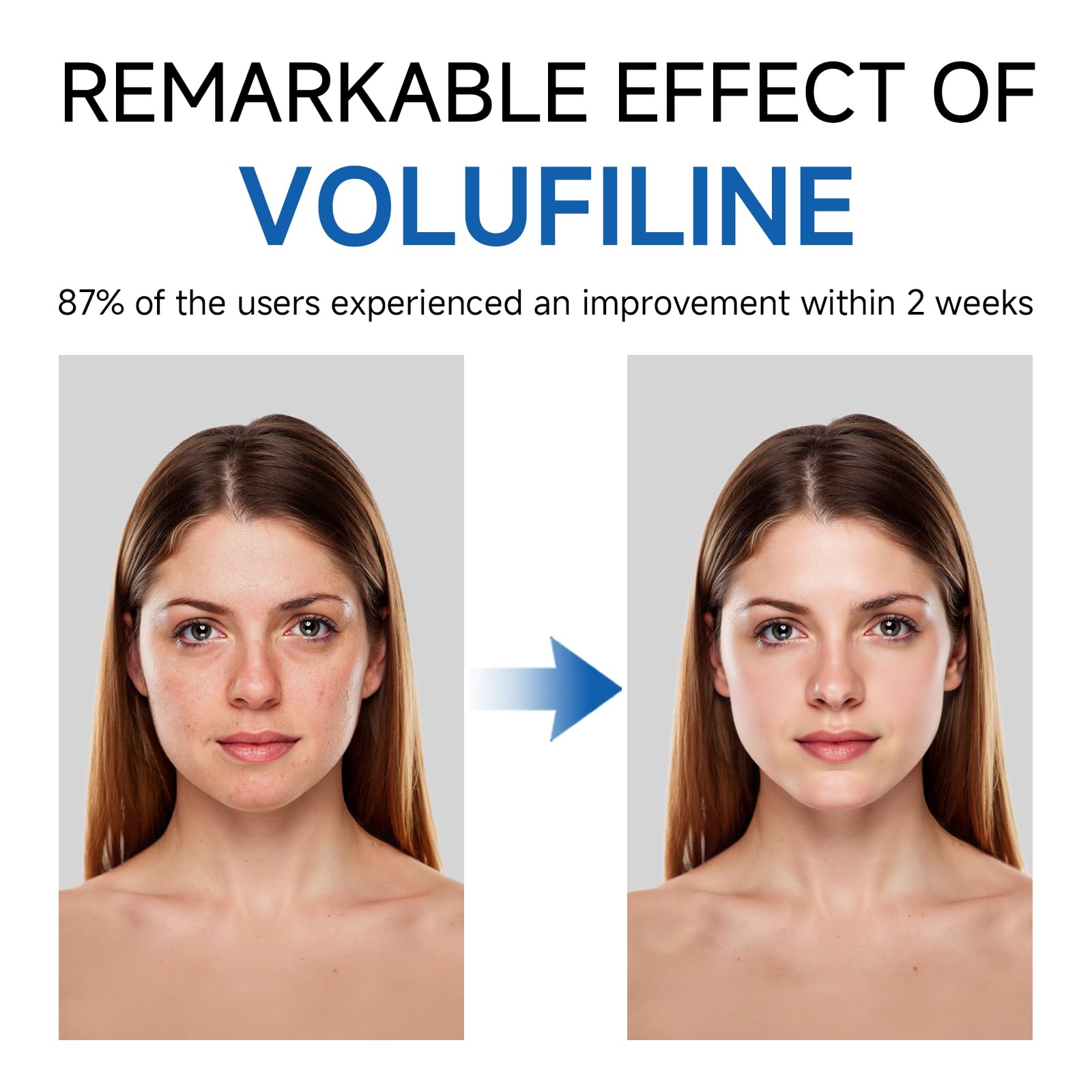 Volufiline Serum, Volufiline Serum Under Eye, Cosmetic Grade Ampoule for Improve Skin Elasticity Face Body Fine Lines Hydrating Texture, 10ml*2