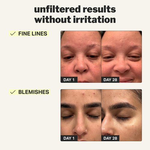 Cocokind Beginner Retinol Gel 0.1%, Improve the Appearance of Fine Lines and Uneven Texture without Irritation, Aloe and Cica to Prevent Dryness, 1 fl oz