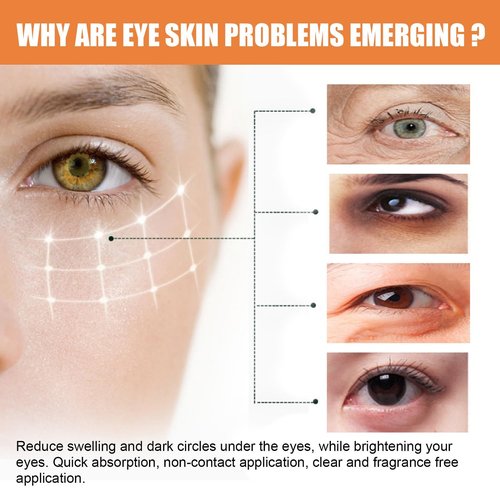 LOYOTICE Vitamin C Eye Balm - Hydrating & Brightening Cream Stick for Dark Circles | 3 Pcs Set