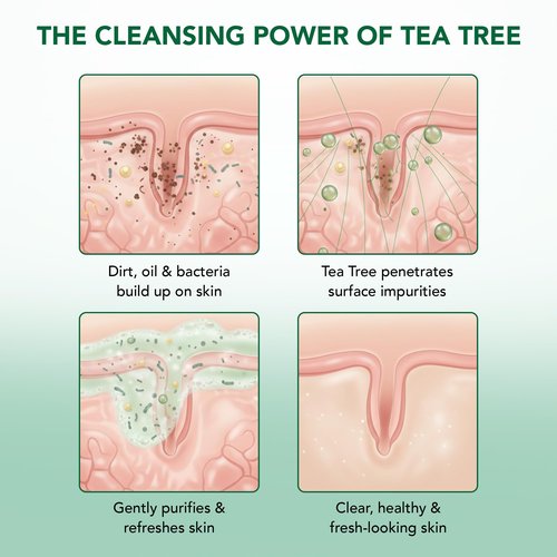 Botanic Hearth Tea Tree Body Wash -16 fl oz- All-Natural Antifungal & Odor-Control Shower Gel for Acne, Athlete’s Foot, Ringworm, Jock Itch & Healthy Skin,Sulfate & Paraben Free, for Men and Women