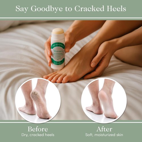 Victoria's Lavender Heel Balm Stick - Ultra-Rich Therapy for Dry, Cracked Feet - Lavender Mint 2.5oz