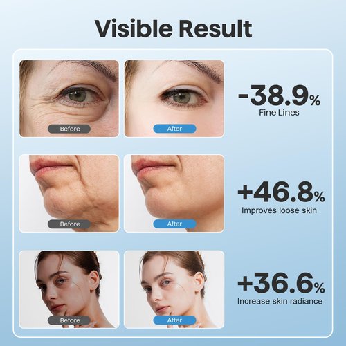 Red Light Therapy for Face, 3 Mode Face Massager Tool with Heating Vibration for Skin Care, Wrinkle Reducer Facial Massager to Soothe and Relax Skin, Micro-Current Face Beauty Device (AM-810B)