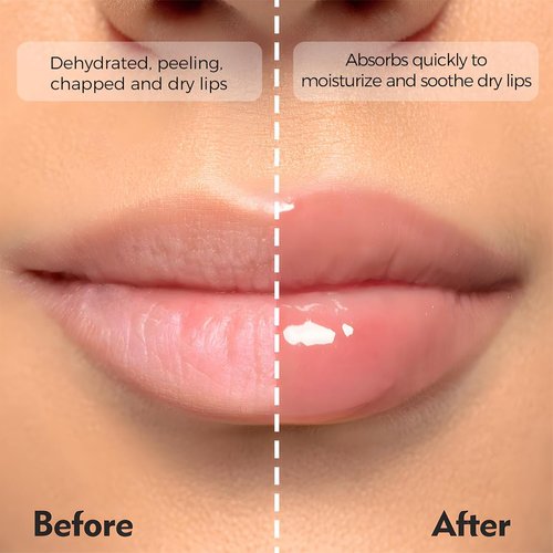 Skiennix Deep Hydrating Lip Butter Balm - Glossy Finish Lip Treatment with Shea Butter & Vitamin E | 2 Pack (Sheer Pink-Unscented)