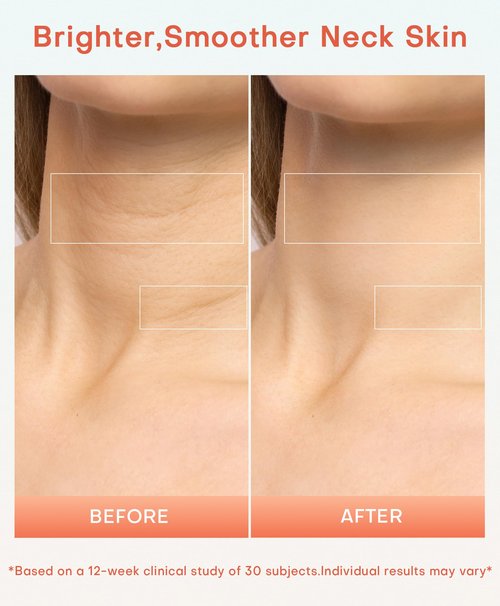 Neck Wrinkle Treatment Device,14 LEDS Red 630nm &12LEDS Infrared Light 850nm LED Mask for Horizontal Lines Turkey Crepey Tech Neck,10-Min Treatment