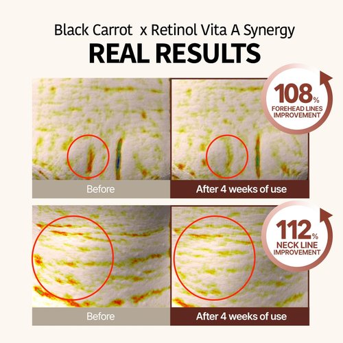 Goodal Black Carrot Vita-A Retinol Eye Cream - Daily Under Eye Treatment for Smooth Skin | K-Beauty