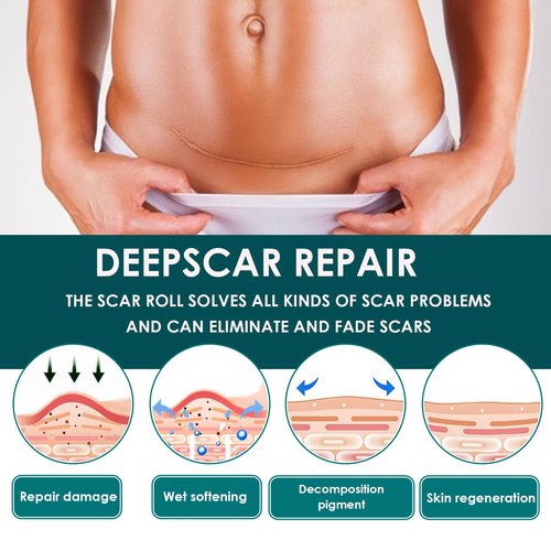 Silicone Scar Tape (1.6"x 120" Roll-3M), Premium Silicone Gel Scar Sheets, Reusable Silicone Patches, Soft Silicone Tape for Surgeries Scars, C-Sections, Wrinkles et