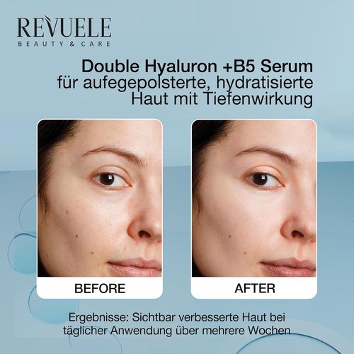 Revuele Double Hyaluron + B5 Serum - Hydrating Face Serum with Hyaluronic Acid | 1 fl. oz