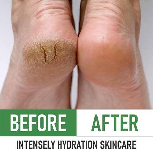 PurOrganica Urea 40% Foot Cream - Intensive Repair for Dry, Cracked Heels & Calluses | Made in USA