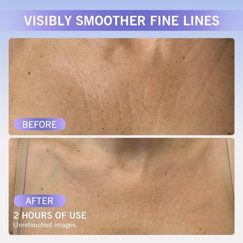 Neck Wrinkle Patches, Reusable Silicone Pads for Chest and Decollete, Overnight Smoothing and Firming, Anti Aging for Fine Lines, Washable Soft Fit, Side Sleeper Support, Anti Wrinkle Pads 4-Pack
