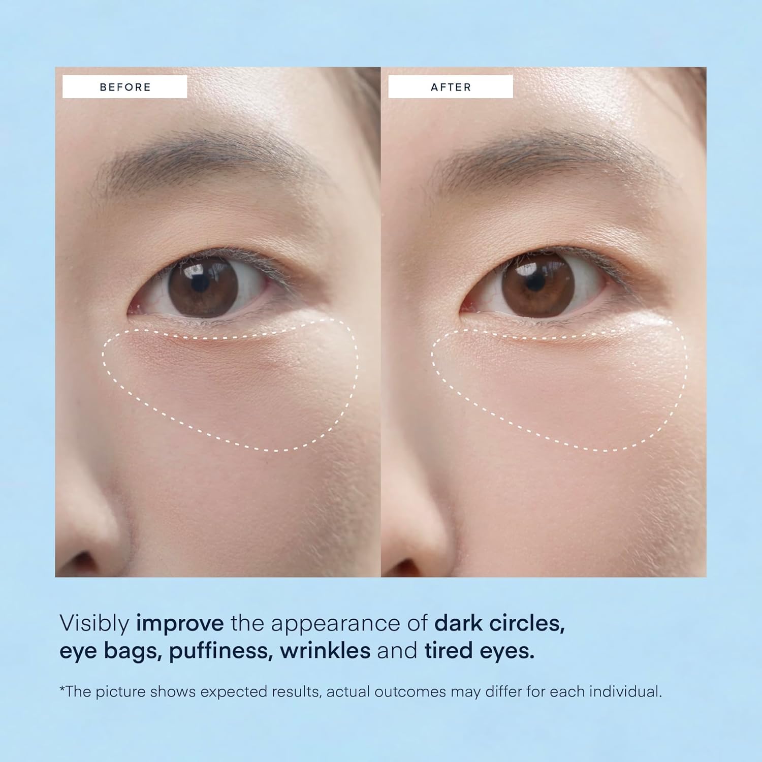 Terez & Honor Under Eye Patches - 60 Korean Hydrogel Masks with Caffeine & Hyaluronic Acid for Dark Circles & Puffiness | Vegan & Fragrance-Free