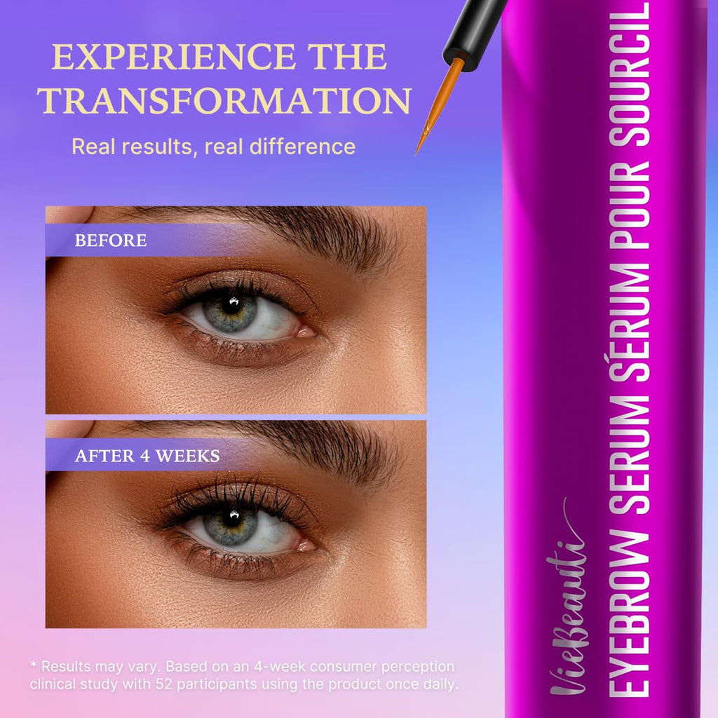 VieBeauti Eyelash Growth Serum - Advanced Formula for Longer, Fuller Lashes | Vegan & Cruelty-Free, 3mL
